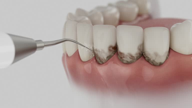 Trusted Tooth Extraction service in Statesboro, GA - Dentist Open Now